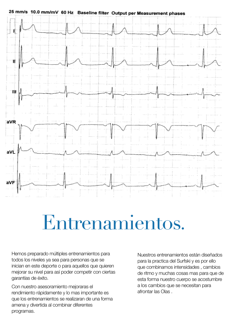 entrenamiento